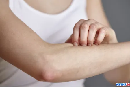 İnsan niyə qaşınır?