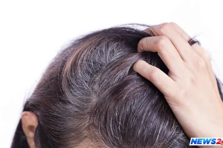 Nəyə görə stressdən saçlar ağarır – Əsas səbəb