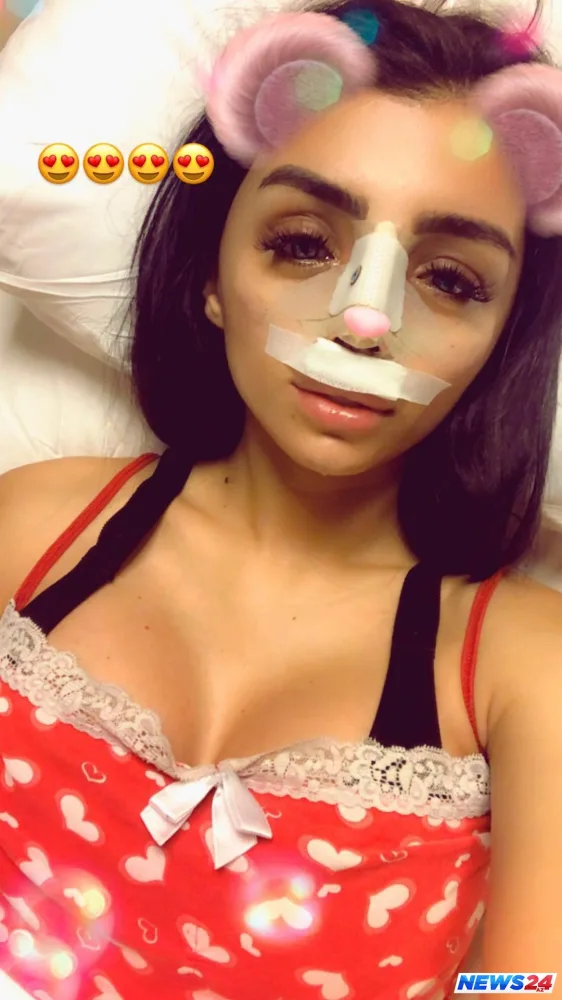 Bu da Renkanın əməliyyatdan sonrakı halı - FOTO