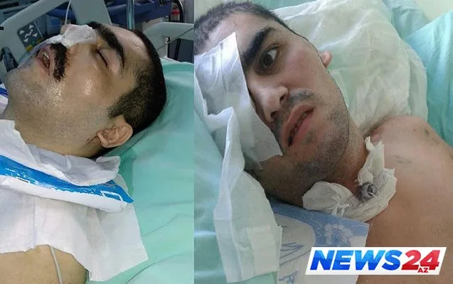 Mehriban Əliyeva Qoşqar Hacıyevin müalicəsini nəzarətə götürdü