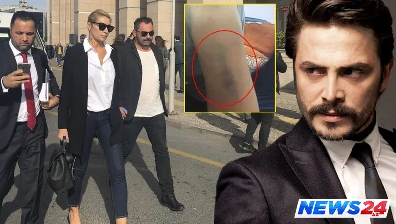 Sıla döyülməsinə münasibət bildirdi