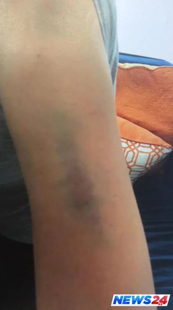 Sıla döyülməsinə münasibət bildirdi