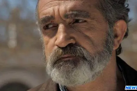 Xalq artistinin qolu sındı – FOTO