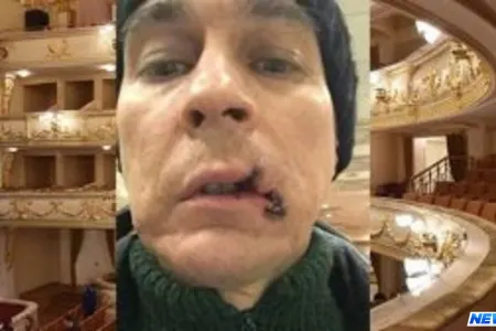 Çıxış vaxtı müğənninin ağzı cırıldı