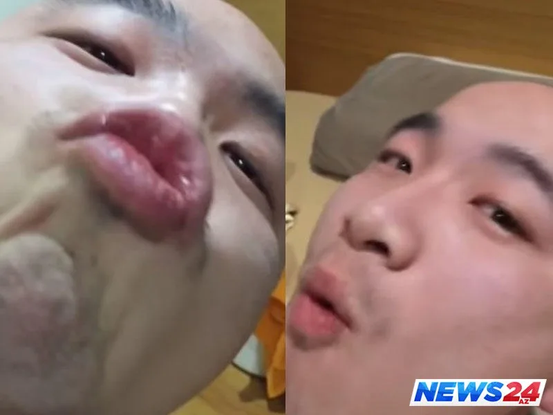 Homoseksual rahibin sevgilisi qisas aldı - FOTO