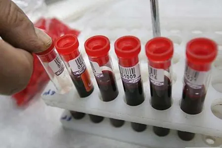 Ölkədə 1 milyon talassemiya daşıyıcısı var