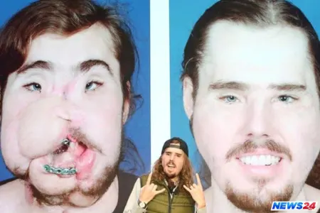 İntihar edən gənc başqasının üzü ilə yaşayır - FOTOLAR