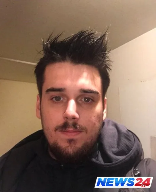 İntihar edən gənc başqasının üzü ilə yaşayır - FOTOLAR