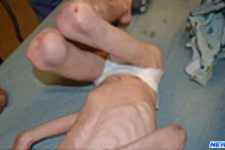 Valideynlərindən uşağa inanılmaz işgəncə - Foto