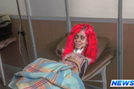 Məşhur aktrisaya bənzəmək istəyən qız özünü bu hala saldı - FOTO