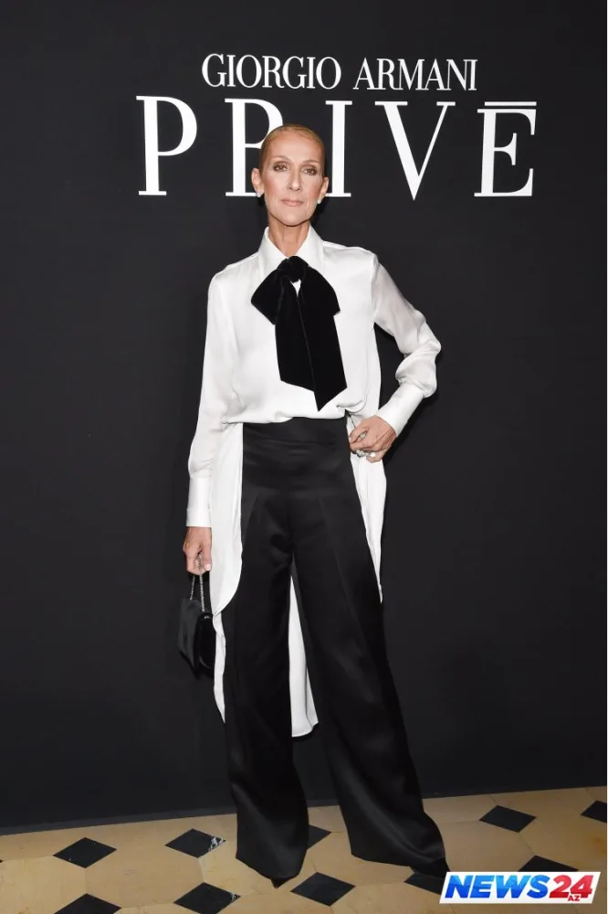 Dünyaca məşhur müğənni tanınmaz halda - FOTOLAR