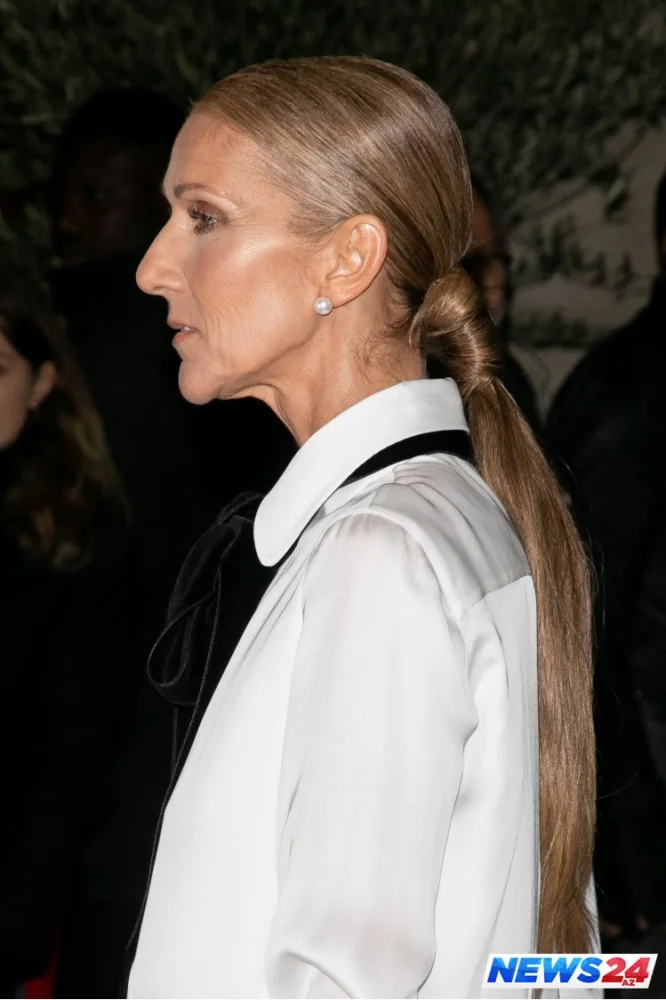 Dünyaca məşhur müğənni tanınmaz halda - FOTOLAR