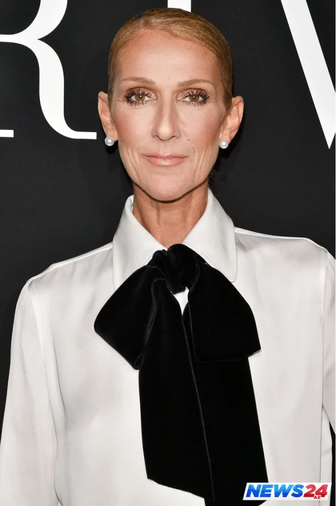 Dünyaca məşhur müğənni tanınmaz halda - FOTOLAR