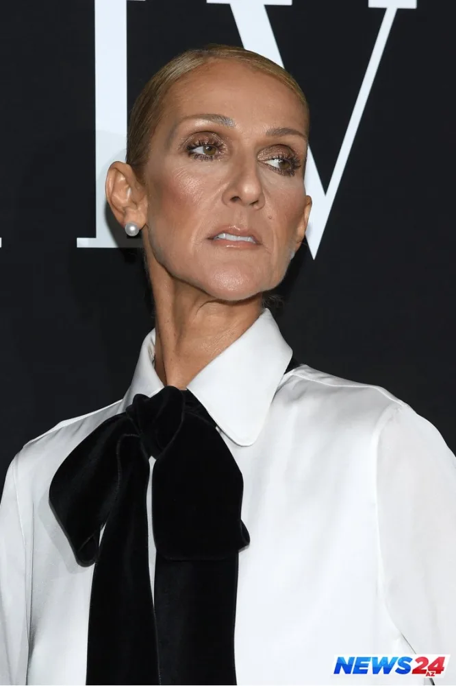 Dünyaca məşhur müğənni tanınmaz halda - FOTOLAR