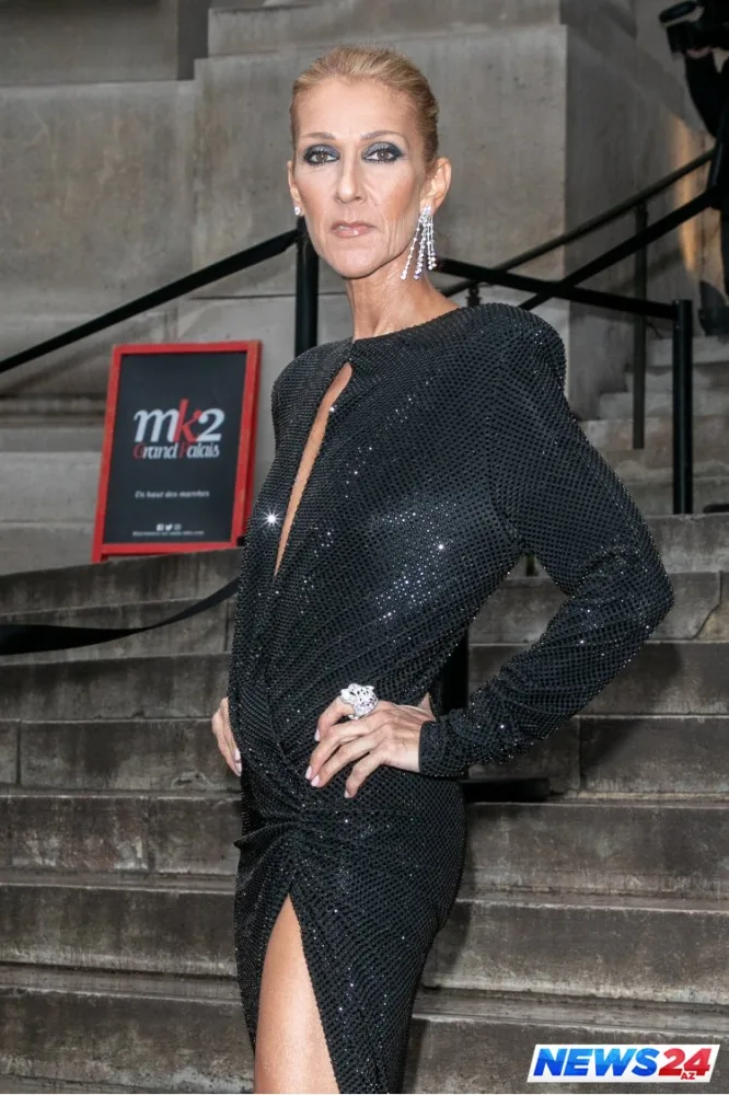 Dünyaca məşhur müğənni tanınmaz halda - FOTOLAR