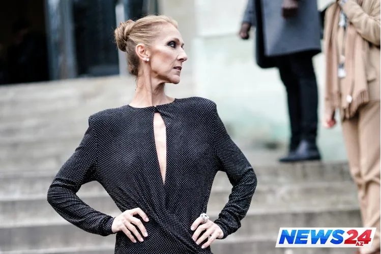 Dünyaca məşhur müğənni tanınmaz halda - FOTOLAR