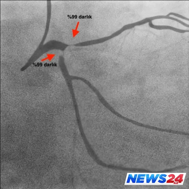 “EGE Hospital”-da daha bir uğurlu əməliyyat - FOTOLAR