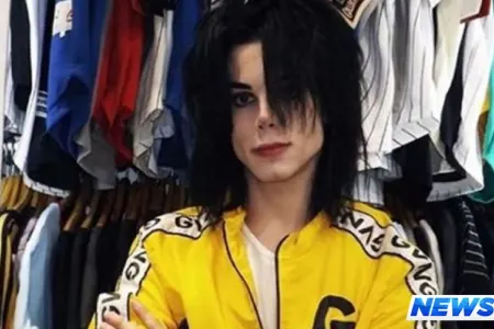 Maykl Ceksona bənzəmək üçün 11 əməliyyat keçirdi - FOTO