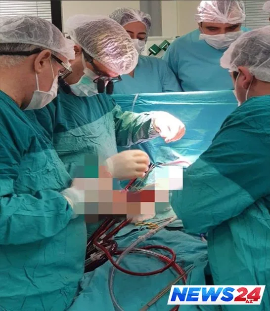Azərbaycanda inanılmaz əməliyyat - Xəstəyə süni ürək köçürüldü - FOTO