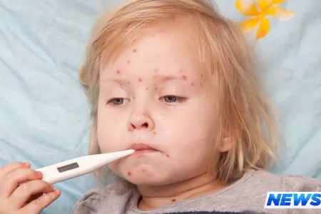 Qızılcadan 1 ayda 70 nəfər ölüb