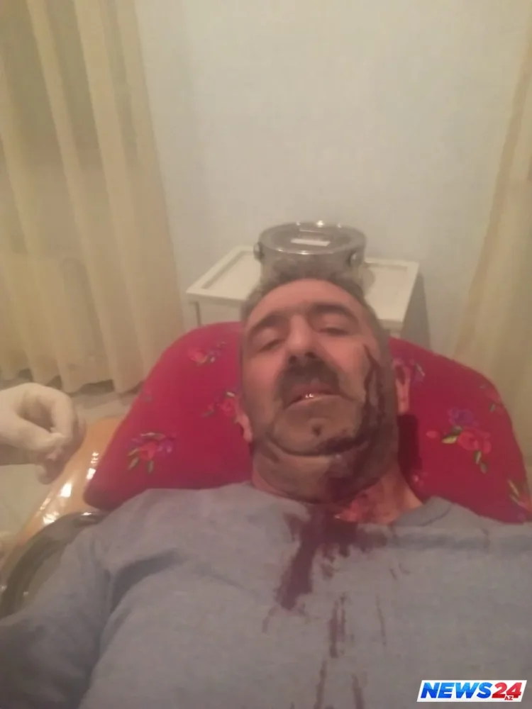 Masallıda qızı qaçırılan ailə oğlan evinə hücum edib - FOTO