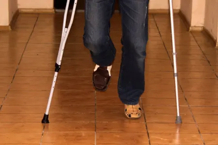 Ayağını sındıran əməkdar artist əsa ilə poza verdi - FOTO