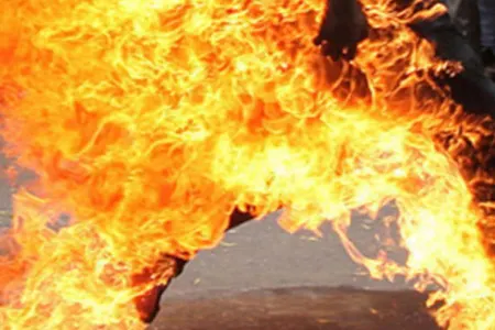 Bakıda 62 yaşlı qadın yanaraq öldü