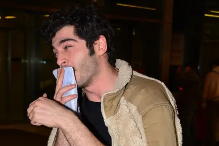 İt aktyorun dodağını dişlədi - FOTO