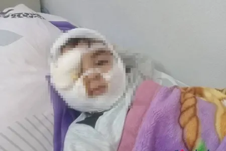 Quduz it 4 yaşlı uşağın üzünü parçaladı, sonra öldü - Bakıda DƏHŞƏT