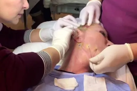56 yaşlı məşhur müğənni canlı yayımda - ÜZ GƏRMƏ ƏMƏLİYYATI ETDİRDİ - FOTO - VİDEO