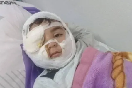 Üzünü it parçalayan Hüseynin atası: Uşağım şikəst oldu - FOTO