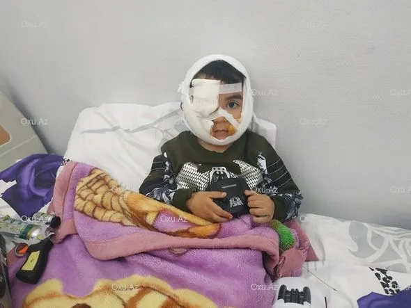Üzünü it parçalayan Hüseynin atası: Uşağım şikəst oldu - FOTO