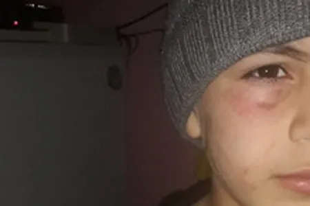 Anası tərəfindən döyülən 9 yaşlı Hüseyn danışdı: - "İNTERNATA GETMƏK İSTƏMİRƏM" - EKSKLÜZİV AÇIQLAMA