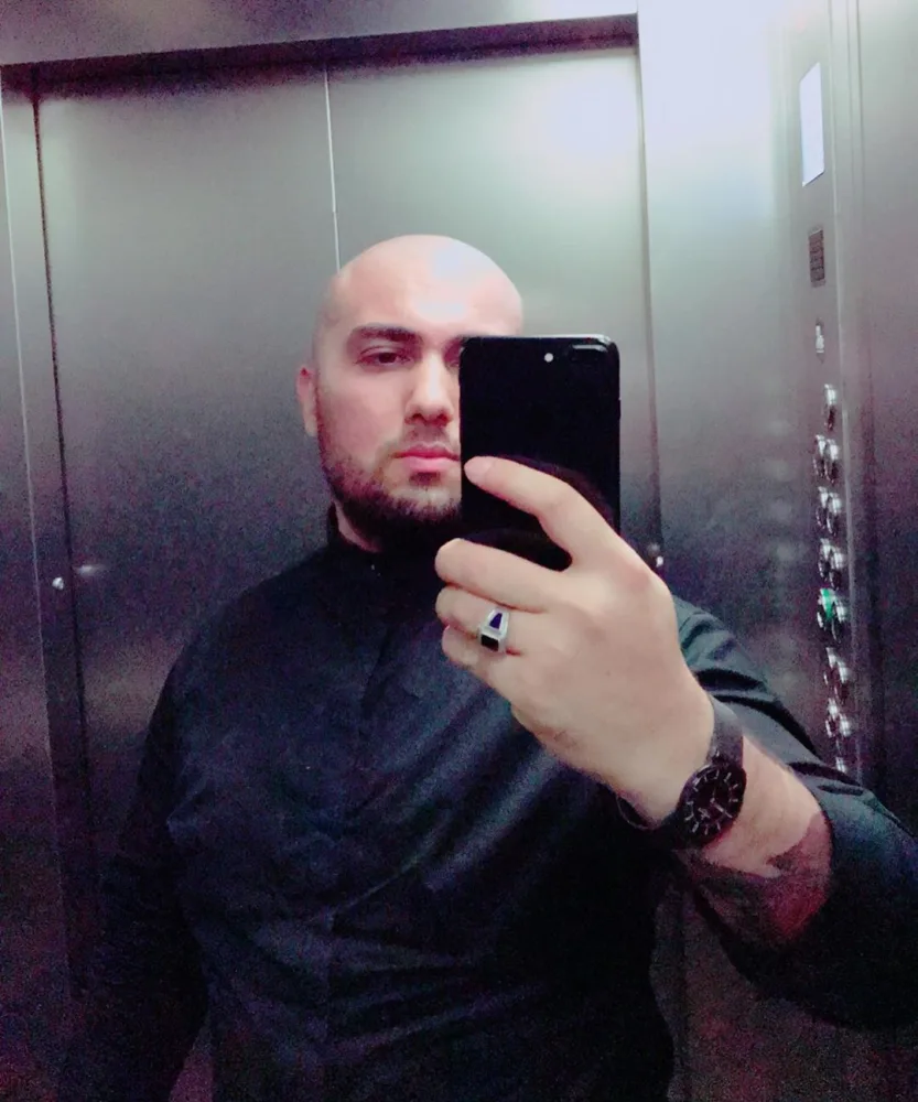 "Toppuş bacı" başını keçəl etdi - FOTO