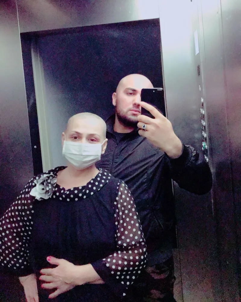 "Toppuş bacı" başını keçəl etdi - FOTO