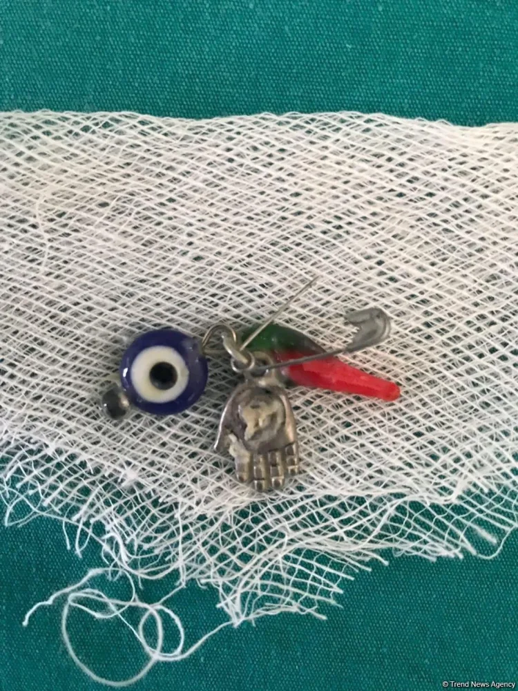 Nəzərdən qorumaq istədilər, amma... - Körpənin mədəsindən bunlar çıxdı - FOTO