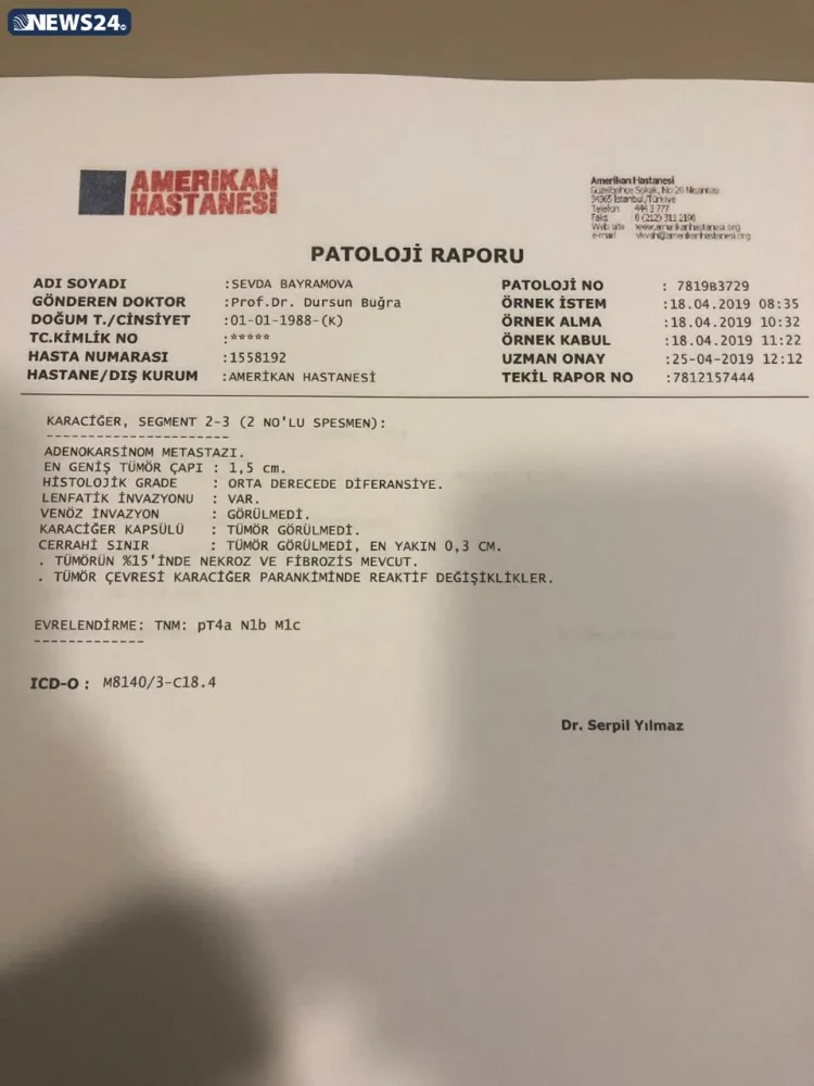 "Mənə düzgün diaqnoz qoyulsaydı, metastaz verməyəcəkdi"- - Tədris Cərrahiyyə Klinikasında QALMAQAL