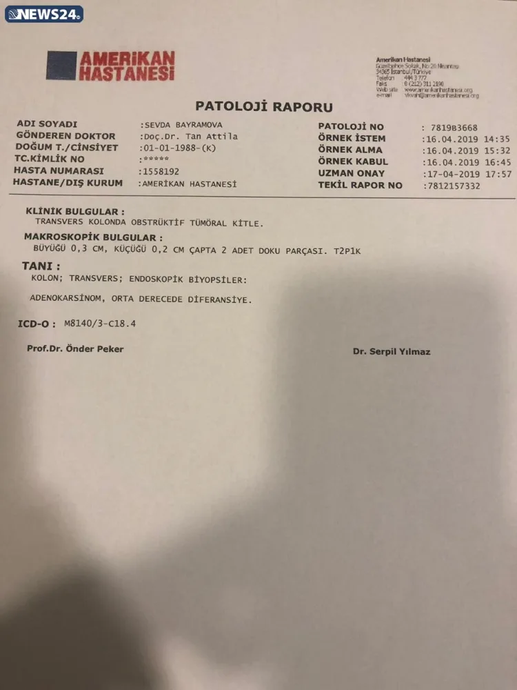 "Mənə düzgün diaqnoz qoyulsaydı, metastaz verməyəcəkdi"- - Tədris Cərrahiyyə Klinikasında QALMAQAL