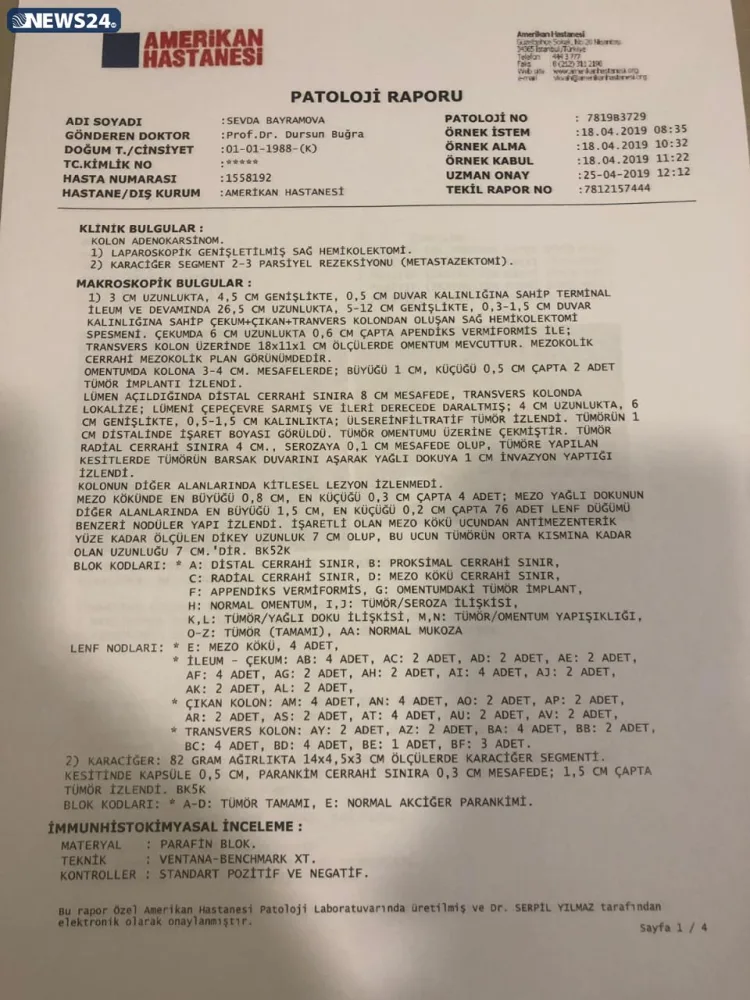 "Mənə düzgün diaqnoz qoyulsaydı, metastaz verməyəcəkdi"- - Tədris Cərrahiyyə Klinikasında QALMAQAL