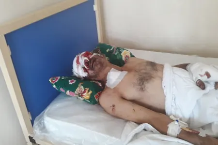 “KamAZ”ın təkəri partladı - Ustanın gözü çıxdı - FOTOLAR