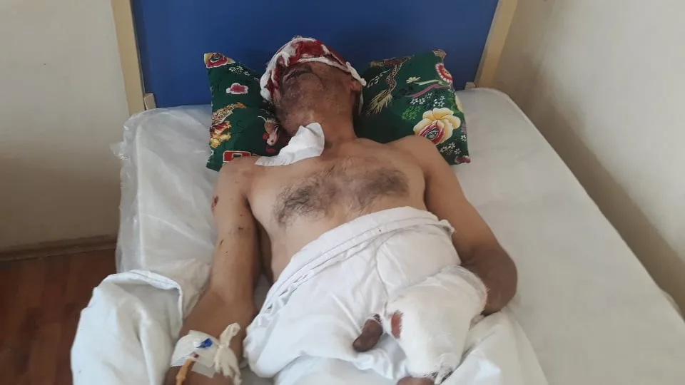 “KamAZ”ın təkəri partladı - Ustanın gözü çıxdı - FOTOLAR