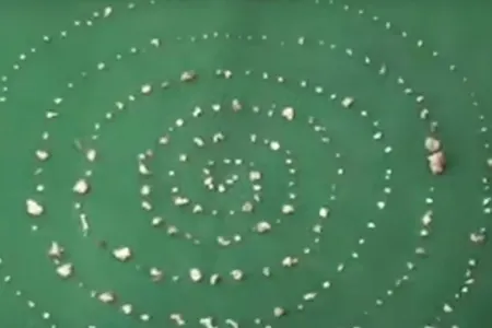 Uşağın ağzından 526 diş çıxarıldı - FOTO - VİDEO