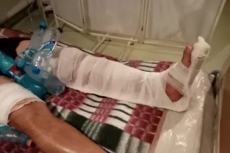Ayağından 3 dəfə güllələdilər