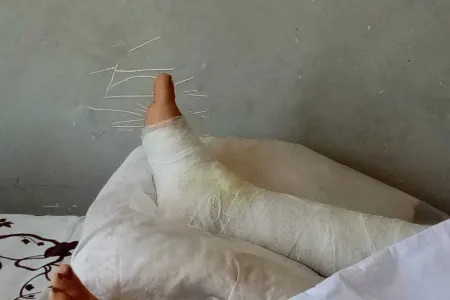 İlan, əqrəb, qaraqurd- - EHTİYATLI OLUN!
