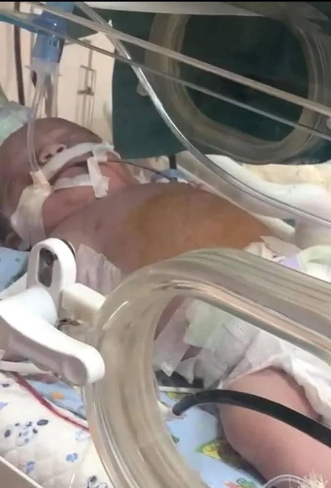 Bakıda unikal cərrahiyyə əməliyyatı- - Rezus uyğunsuzluğu olan ana və körpə xilas olundu - FOTO