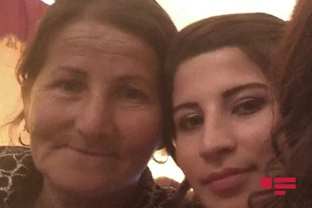 Əri tərəfindən yandırılan qadının - DƏHŞƏTLİ FOTOSU