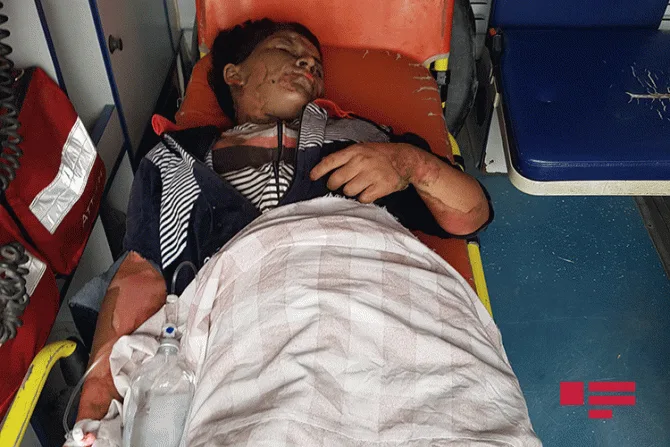 Əri tərəfindən yandırılan qadının - DƏHŞƏTLİ FOTOSU