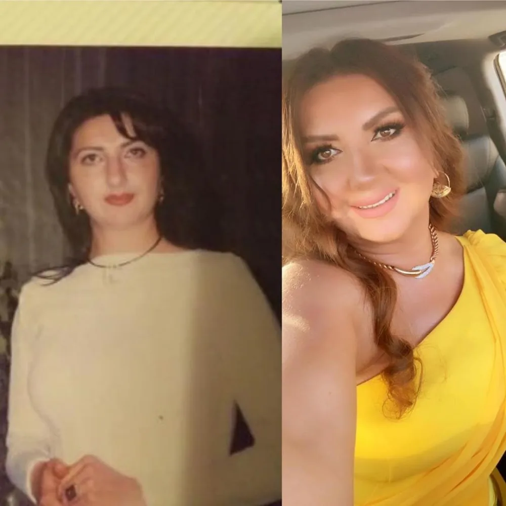 Nazilə keçmiş şəklini paylaşdı, tənqid olundu - "Ağ gün adamı ağardır" - FOTO