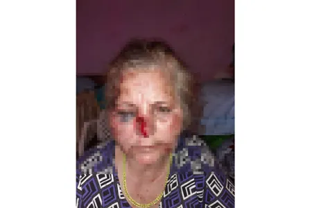 Kürəkəni tərəfindən döyülən qaynananın - Dəhşətli görüntüləri -Foto