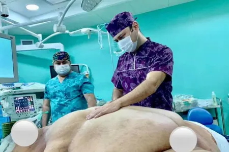 Azərbaycanda 256 kiloqramlıq qadının üzərində - İNANILMAZ ƏMƏLİYYAT - FOTO